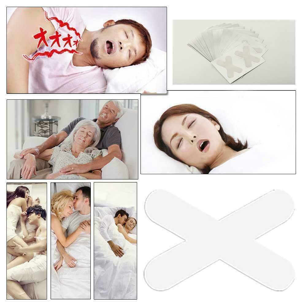 Bộ 30 Nút Chặn Miệng Chống Ngáy Khi Ngủ Hình Chữ X Tiện Dụng