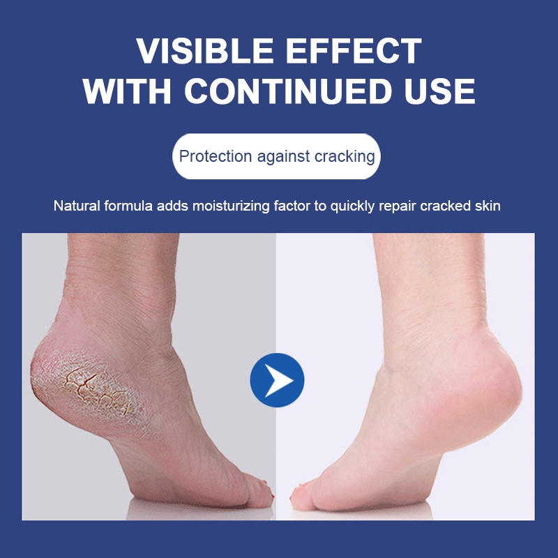 Kem dưỡng da chân SEVICH vaseline siêu dưỡng ẩm phục hồi da khô và nứt nẻ 80g