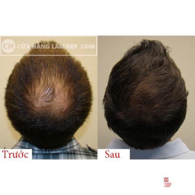 Thuốc bôi kích thích mọc tóc Sato Nhật Bản | BigBuy360 - bigbuy360.vn
