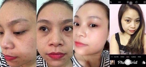 Kem cá mập HONGIK SKIN