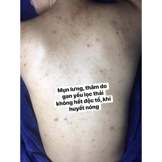 Sữa Tắm Kén Tằm DVi nature
