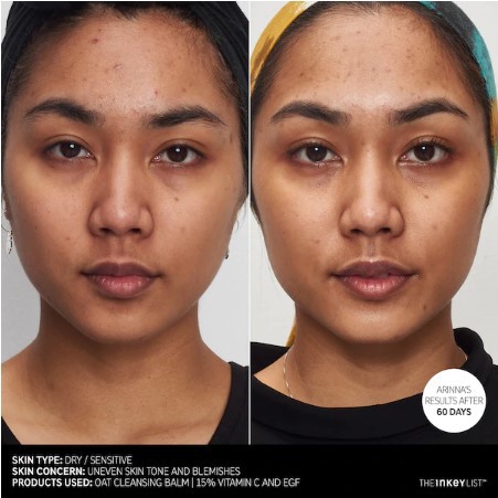 Serum sáng da The Inkey List 15% Vitamin C and EGF 30ml