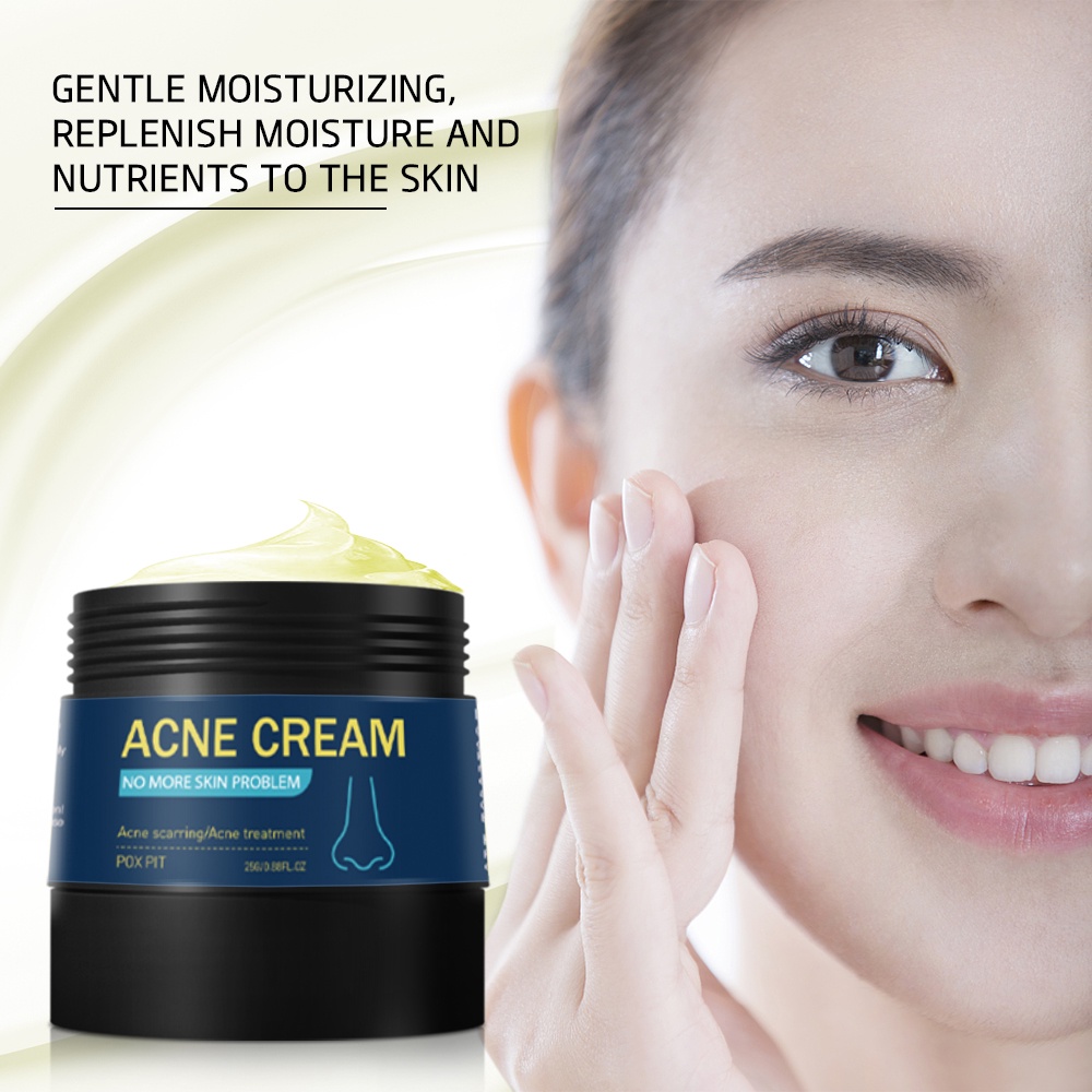 ACNE CRAM - Ngăn Ngừa Sẹo, Mụn, Thâm, Nám, Rạn Da 25g