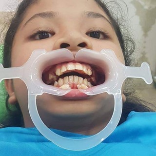 Banh miệng 3 chiều nha khoa