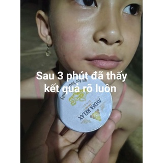 Cao Xoa Bóp Massage Thảo Dược Cải Thiện Đau Nhức Ayofa Relax 60g hương Sả