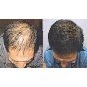 Tinh dầu vỏ bưởi cho tóc, da (Grapefruit) 10ml - 30ml - 50ml - 100ml | BigBuy360 - bigbuy360.vn