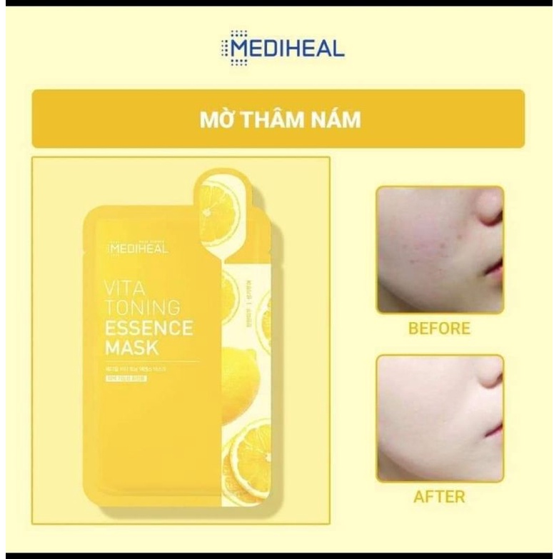 🌞 MẪU MỚI Mặt nạ MEDIHEAL 2021 🌞 | BigBuy360 - bigbuy360.vn