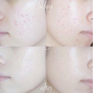 Phấn April Skin SPF50+++PA++