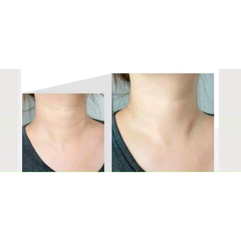 Kem dưỡng da cổ Medi peel naite thread neck cream - Hàng chính hãng