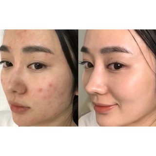 GEL RỬA MẶT COMPLIMENT NO PROBLEM