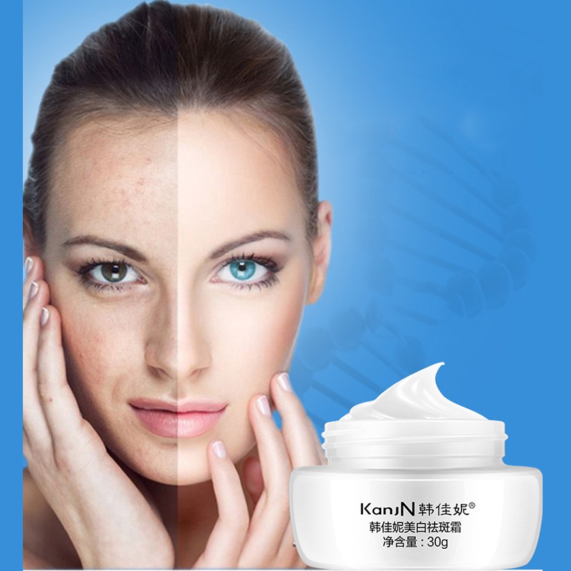 Kem dưỡng trắng KanjN Whitening Freckle Cream tăng tone sáng, hết tàn nhang, hết vết thâm, hết nám da, hết vết cháy nắng