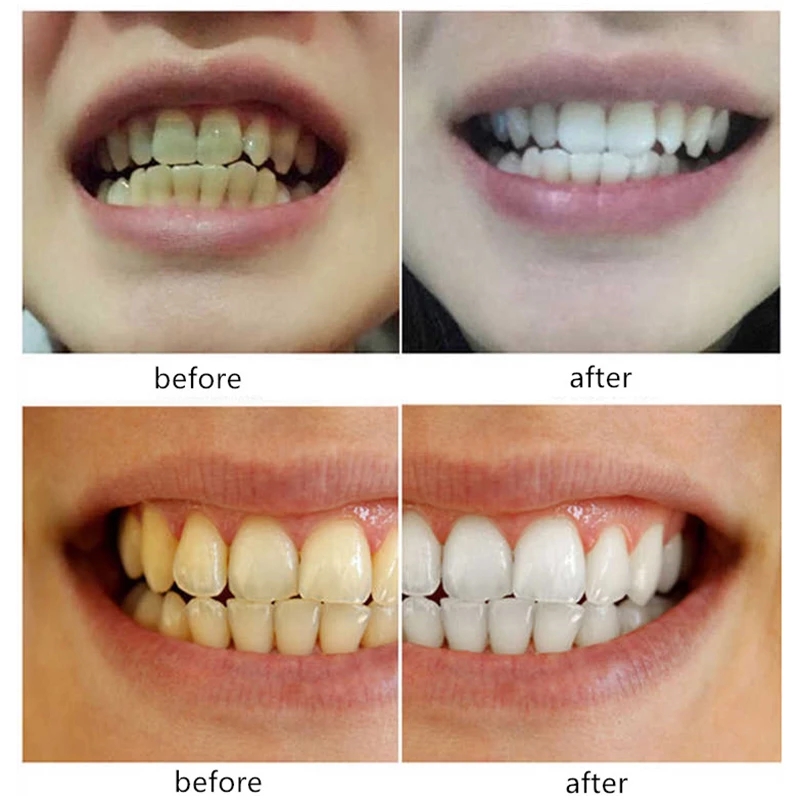 Bột Làm Trắng Răng Chất Lượng Cao