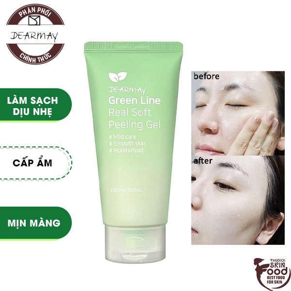 Tẩy Tế Bào Chết Dạng Gel Dearmay Green Line Real Soft Peeling Gel 150ml