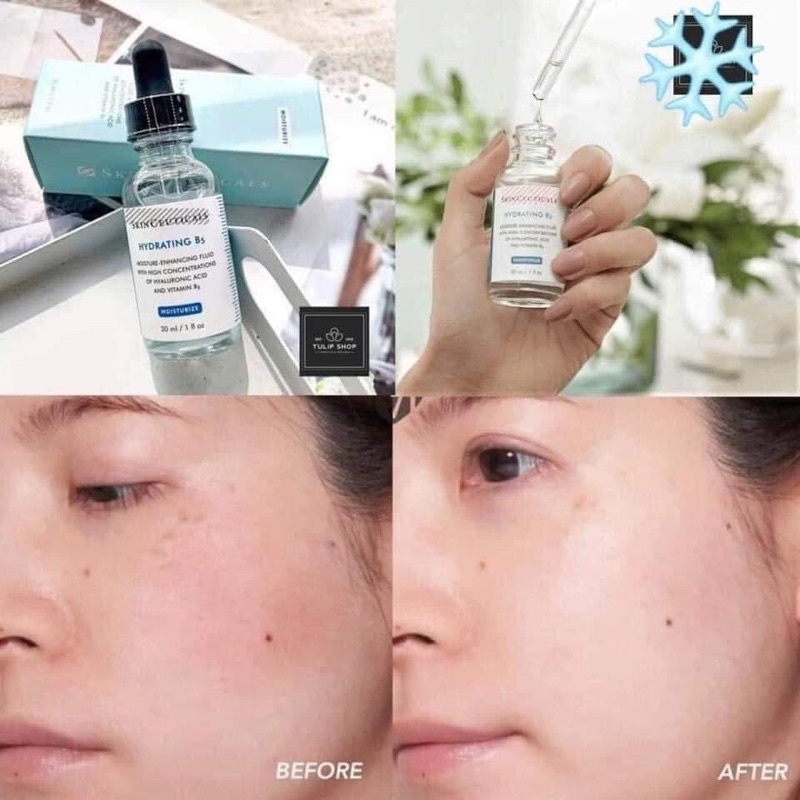 SERUM B5 HYDRATING SKINCEUTICAL- PHỤC HỒI THẦN THÁNH