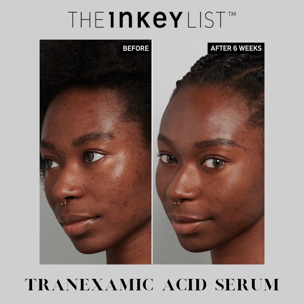 Tinh chất làm đều màu da The Inkey List Tranexamic Acid Serum - 30ml