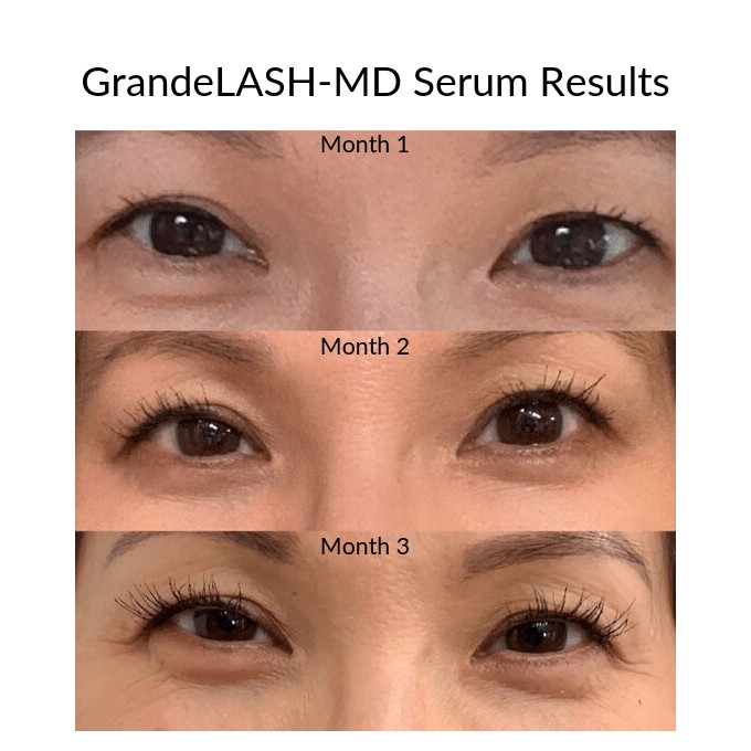 Tinh chất dưỡng dài mi GrandeLash MD Lash Enhancing Serum Grande Cosmetic