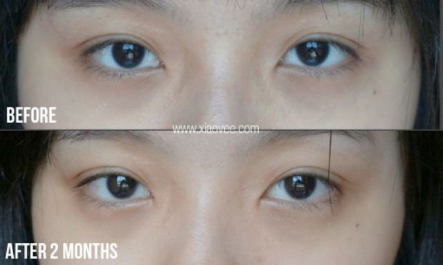 Tinh dầu Genifique Yeux Light Pearl Lancôme đầu lăn | BigBuy360 - bigbuy360.vn