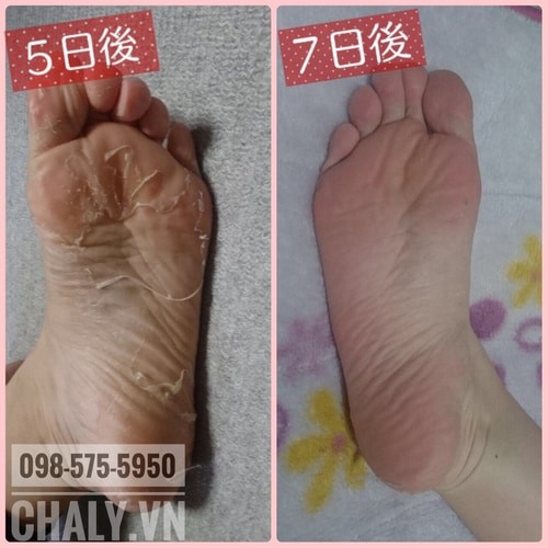 Túi ủ chân tẩy da chết Miimeow Peeling Socks Nhật mẫu mới nhất vừa về. Nội địa Nhật chính hãng