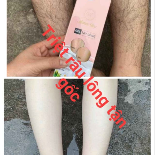 ( mua 1 tặng 1 SERUM CAO TRIỆT) Kem triệt râu lông MAMENSHOP tận gốc vĩnh viễn trắng da thiên nhiên | BigBuy360 - bigbuy360.vn