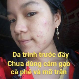 Mỡ trăn nguyên chất N'Store