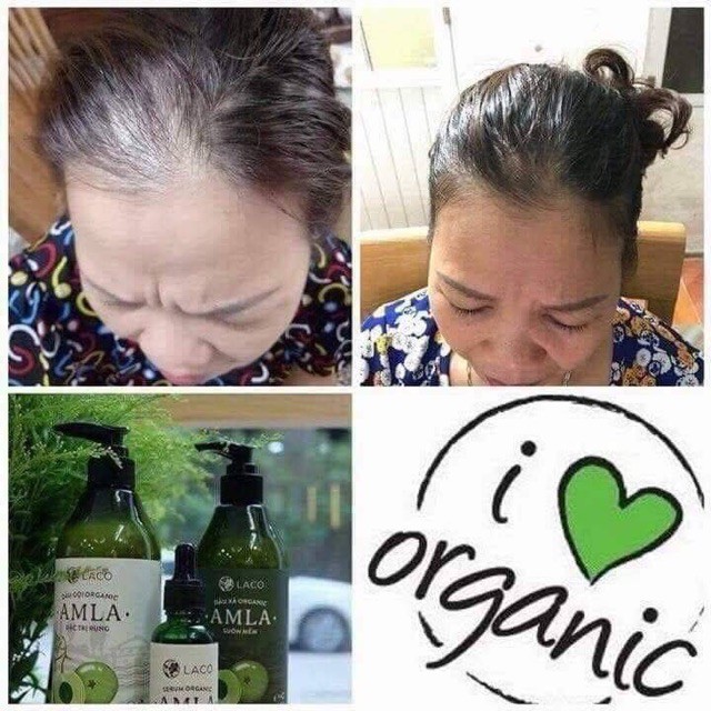 DẦU XẢ AMLA ĐẶC TRỊ RỤNG TÓC - ORGANIC 100% | BigBuy360 - bigbuy360.vn