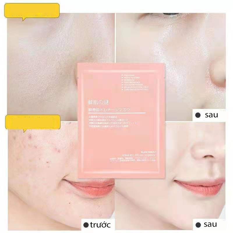 Combo 10 Mặt Nạ/Mask Nhau Thai Cừu Rwine Beauty Cuống Rốn Tế Bào Gốc Nhật Bản Dưỡng Da, Cung Cấp Độ Ẩm, Tái Tạo Collagen