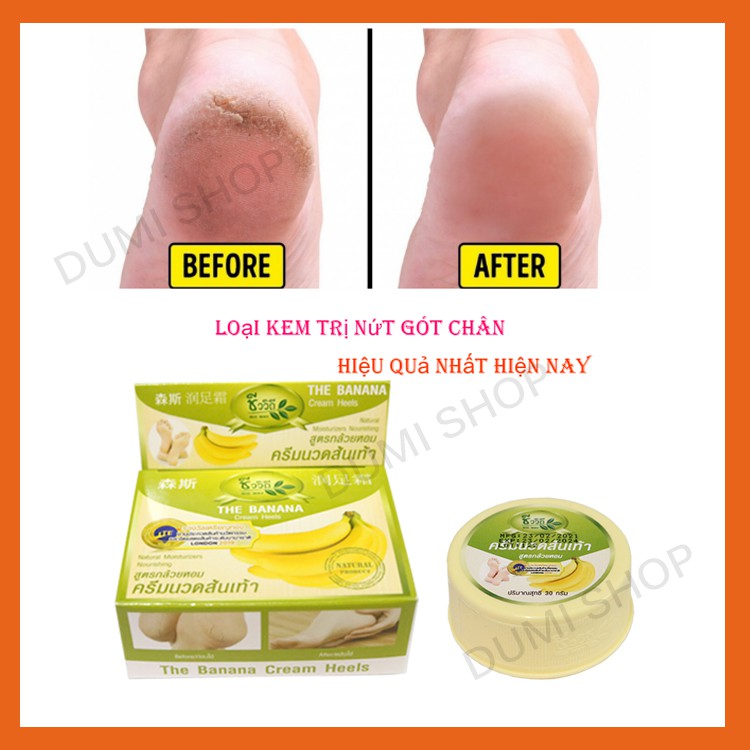 Kem nứt gót chân chuối Thái Lan Banana Cream Heels 30g - Dumi Shop | BigBuy360 - bigbuy360.vn
