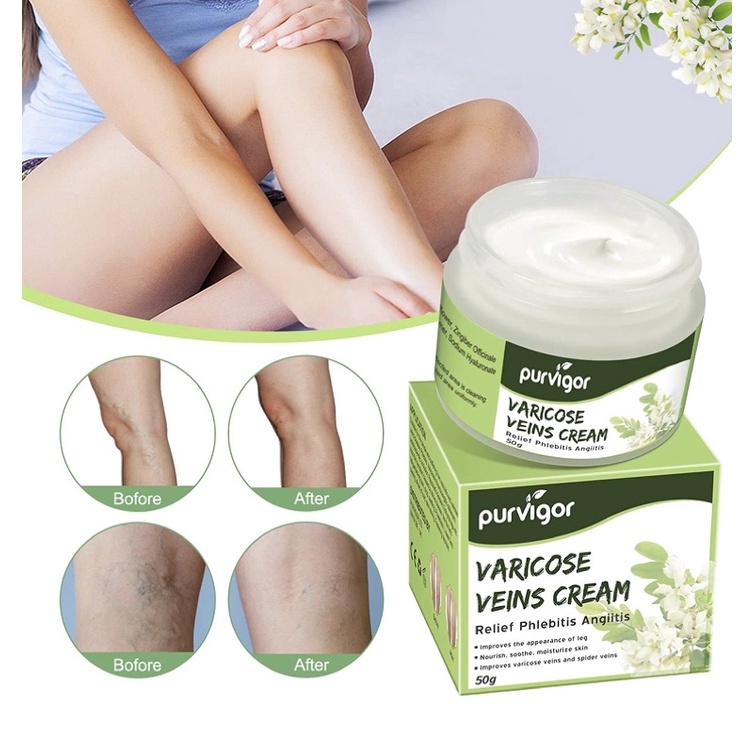 Kem hỗ trợ giãn tĩnh mạch chân Purvigor Varicose Veins Relief Cream 50g USA