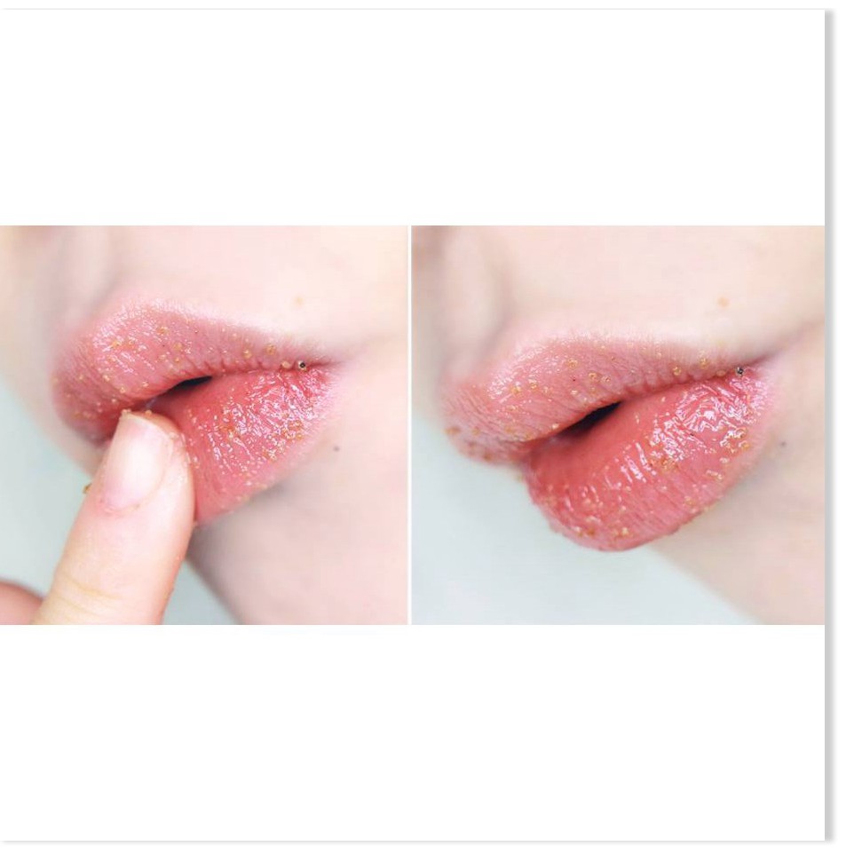 Tẩy tế bào chết môi Beauty Treats Lip Scrub | BigBuy360 - bigbuy360.vn