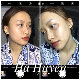 Serum tẩy da chết hóa học Red Peel