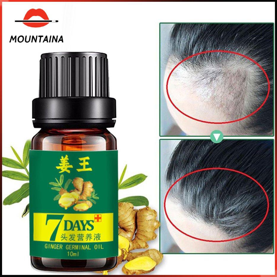 (Hàng Mới Về) Tinh Dầu Gừng Chăm Sóc Tóc 10ml Tiện Dụng