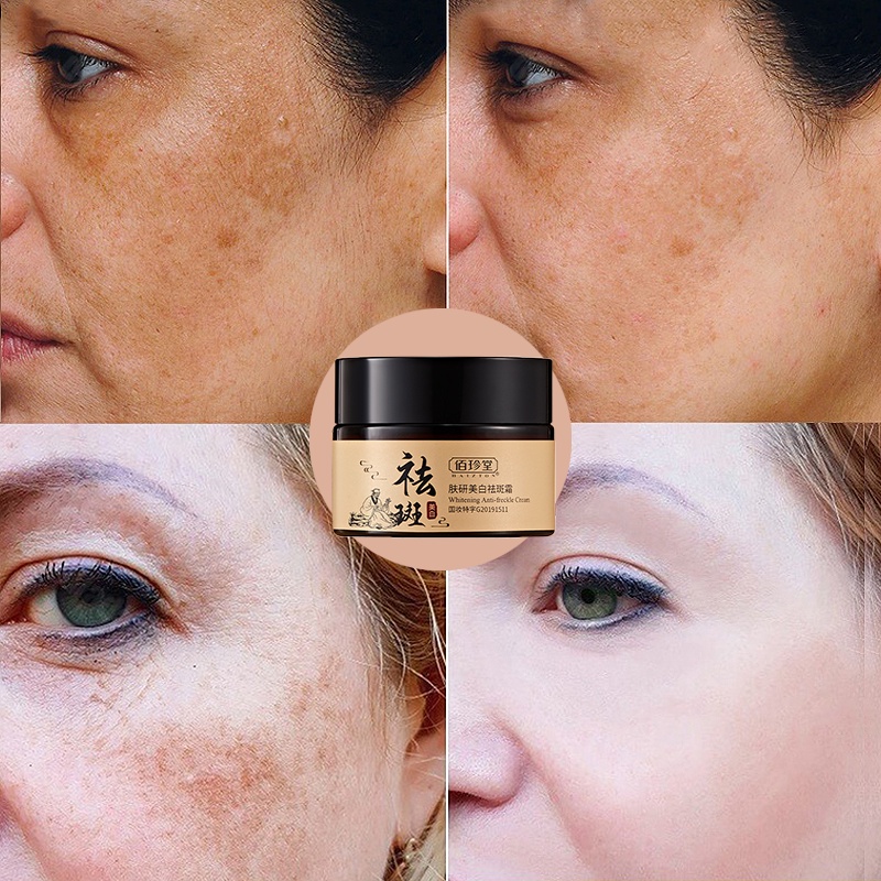 kem xóa nám làm trắng da tinh chất vitamin C kem dưỡng da mặt collagen Tinh chất  sóc da làm mờ tàn nhang có hiệu quả