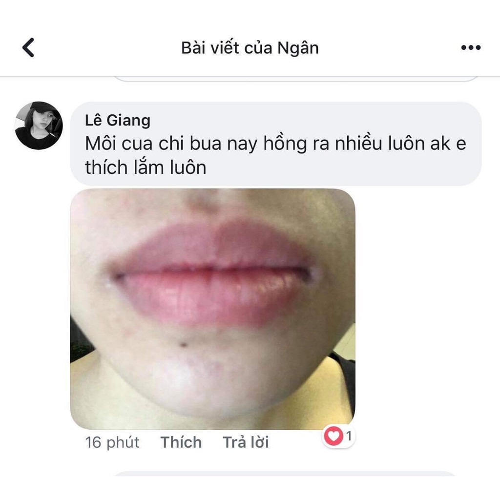 [FREESHIP] Kem khử thâm làm hồng môi Hàn Quốc Xxvirgin 5ml có tác dụng sau 5 ngày | BigBuy360 - bigbuy360.vn