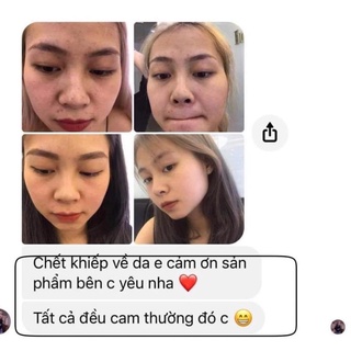 Thảo dược tái tạo da Feather Life