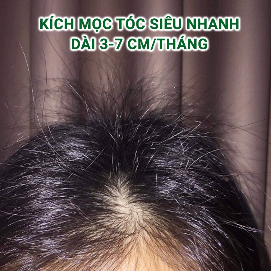 Xịt dưỡng tóc tinh dầu bưởi, kích mọc tóc, giảm gãy rụng GIỌT LÀNH 100ml | BigBuy360 - bigbuy360.vn