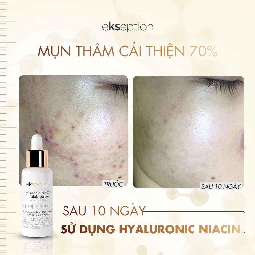 Serum Ekseption Hyaluronic Niacin dưỡng ẩm mờ thâm sáng da 75ml