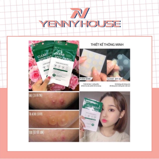 Miếng Dán Mụn Some By Mi Clear Spot Patch (Set 18 Miếng)
