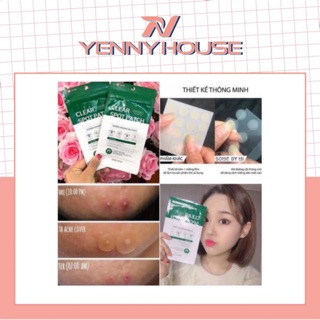 Miếng Dán Mụn Some By Mi Clear Spot Patch (Set 18 Miếng)