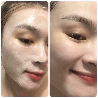 1 Lọ Cấy Phấn MESOWHITE Trắng Da Cao Cấp Chính Hãng