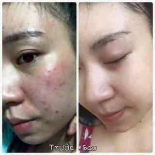 Kem face n collagen