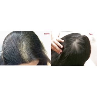 Tinh Chất Mọc Tóc Radical Med 5ml Cho Nữ