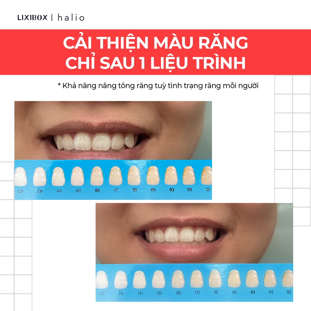 Set 7 Miếng Dán Trắng Răng Không Ê Buốt Halio Teeth Whitening Strip