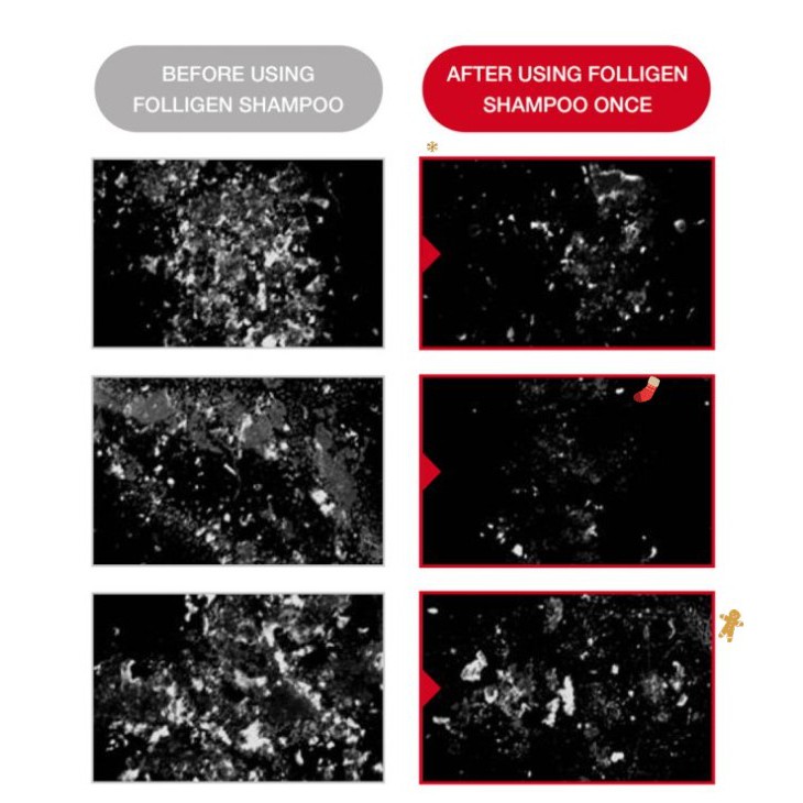 Dầu gội đầu DR.FORHAIR FOLLIGEN 500ml