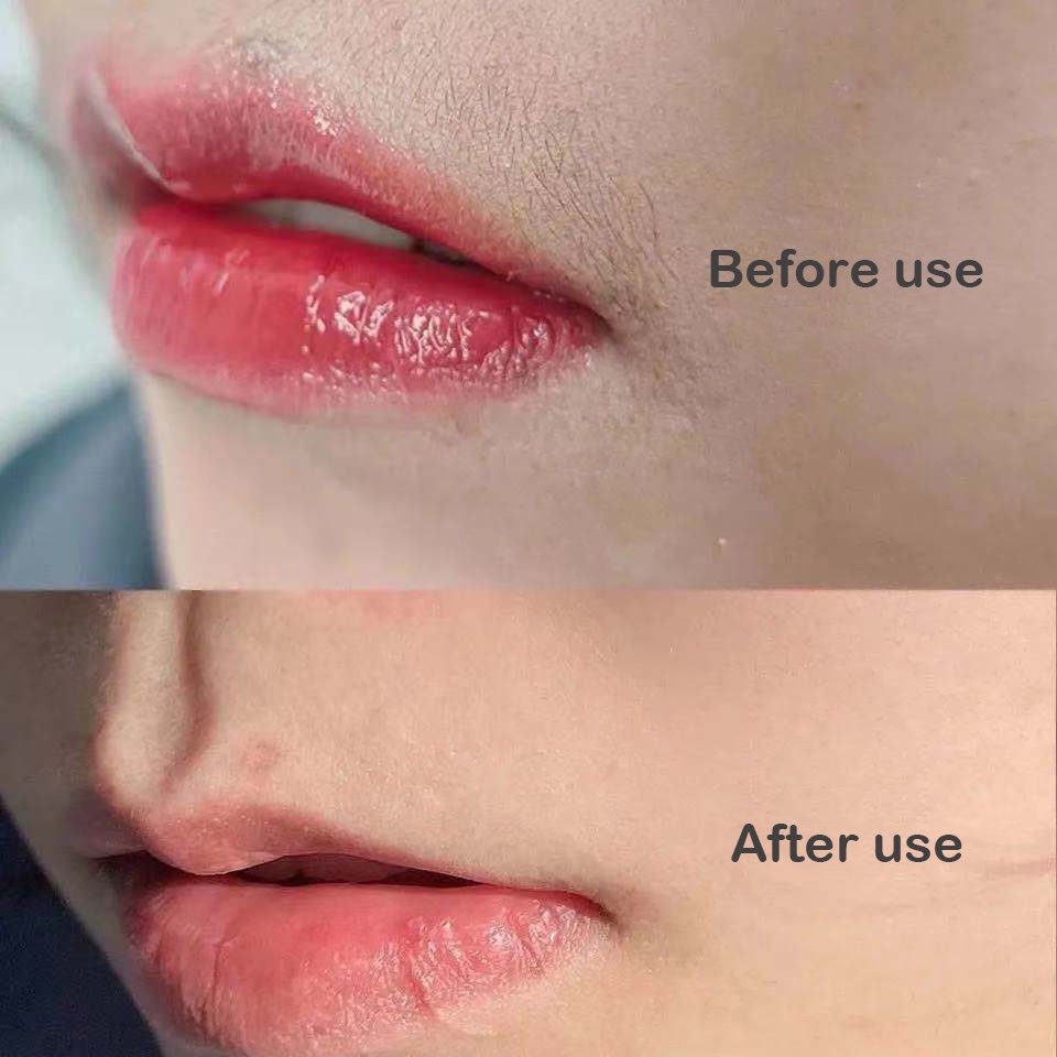 Bộ 10 Miếng Dán Tẩy Lông Không Đau Chuyên Nghiệp Cho Nữ