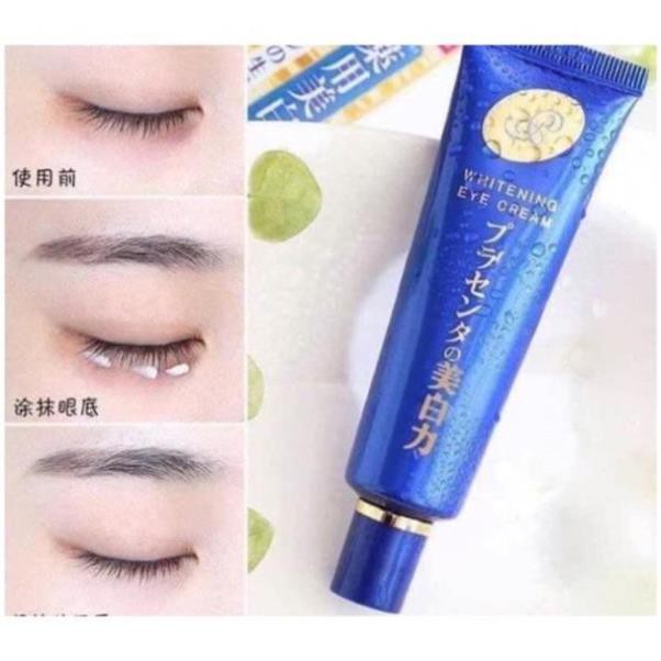 Kem Dưỡng Mắt Meishoku Whitening Eye Cream Nhật Bản 30g cho da nhăn, thâm quầng vùng mắt