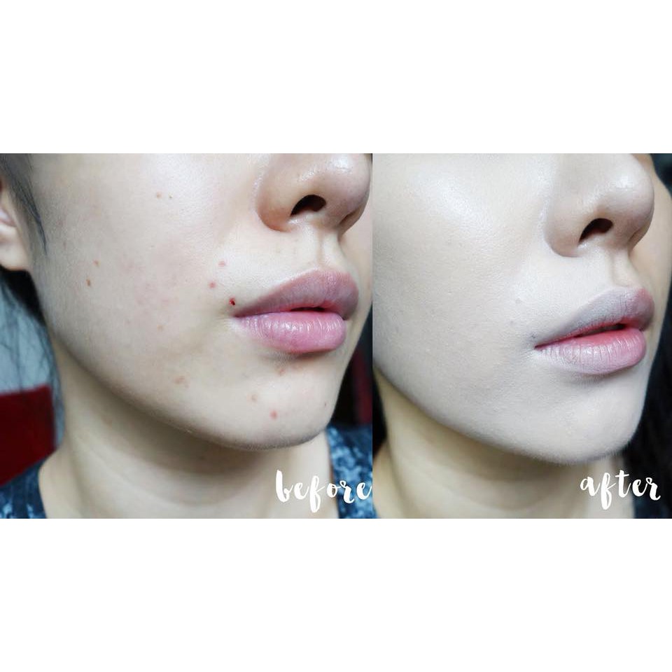 Phấn Nước Che Phủ Hoàn Hảo Aprilskin Black Magic Snow Cushion Mẫu Mới | BigBuy360 - bigbuy360.vn