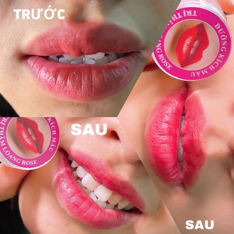 Son dưỡng môi ROSE - dưỡng môi sau phun xăm chống thâm loang