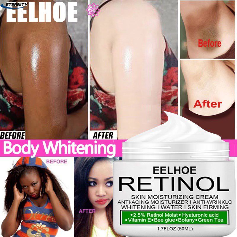 Eelhoe Retinol Trắng Da Tẩy Trắng Da Mặt Trắng Da Toàn Thân Tư Nhân Phần Nách Chân Đầu Gối Sửa Chữa Kem 50Ml VN