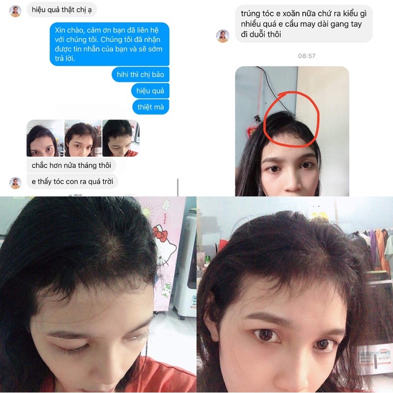 Tinh dầu bưởi thỏ ngọc + Dầu gội bồ kết | BigBuy360 - bigbuy360.vn