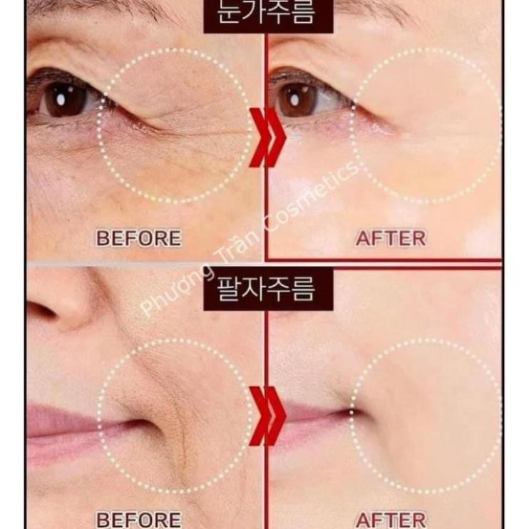 Combo kem và serum giảm nhăn cho vùng mắt Ohui Age Recovery